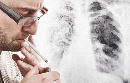 Lung Cancer and Smoking?, Risk Factors, Quiting, Cancer, Lung, Smokin
