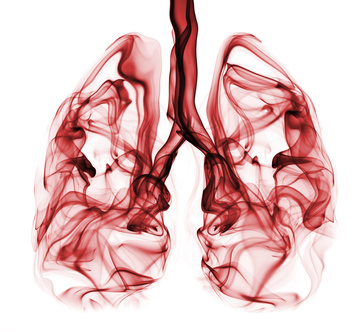 What are the Signs and Symptoms of Lung Cancer?, Bronchitis, Pneumonia, Yellow Skin, Signs, symptoms, Lung, Cancer